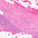 Image for article titled Flesh-Eating Bacteria Wishing It Hadn’t Filled Up On Foot